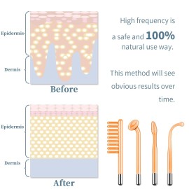 High Frequency Facial Machine - TUMAKOU Portable Handheld High Frequency Facial Skin Wand Machine with 4 Different Tubes High Frequency Facial Machine - TUMAKOU Portable Handheld High Frequency Facial Skin Wand Machine with 4 Different Tubes