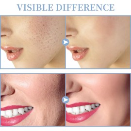 High Frequency Facial Machine - TUMAKOU Portable Handheld High Frequency Facial Skin Wand Machine with 4 Different Tubes High Frequency Facial Machine - TUMAKOU Portable Handheld High Frequency Facial Skin Wand Machine with 4 Different Tubes