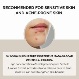 SKIN1004 Madagascar Centella Asiatica Ampoule Facial Serum 1.85 fl.oz, 55ml, Soothes Acne Prone and Sensitive Skin SKIN1004 Madagascar Centella Asiatica Ampoule Facial Serum 1.85 fl.oz, 55ml, Soothes Acne Prone and Sensitive Skin