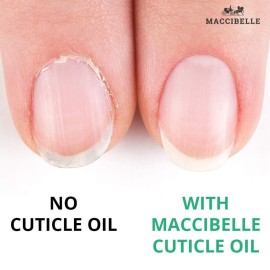 Maccibelle Cuticle Oil 0.5 oz - Heals Dry Cracked Cuticles (Milk and Honey, 0.5 Fl Oz) Maccibelle Cuticle Oil 0.5 oz - Heals Dry Cracked Cuticles (Milk and Honey, 0.5 Fl Oz)