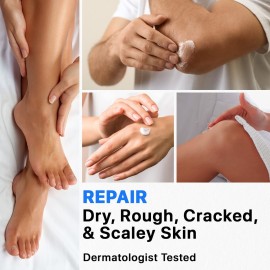Ebanel Urea Cream 40% plus Salicylic Acid 2%, Foot Cream for Dry Cracked Heels Feet Knees Elbows Hands, Foot Dead Skin Cuticle Callus Remover Toenail Softener, Keratolytic Skin Barrier Repair Cream Ebanel Urea Cream 40% plus Salicylic Acid 2%, Foot Cream for Dry Cracked Heels Feet Knees Elbows Hands, Foot Dead Skin Cuticle Callus Remover Toenail Softener, Keratolytic Skin Barrier Repair Cream