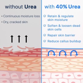 Ebanel Urea Cream 40% plus Salicylic Acid 2%, Foot Cream for Dry Cracked Heels Feet Knees Elbows Hands, Foot Dead Skin Cuticle Callus Remover Toenail Softener, Keratolytic Skin Barrier Repair Cream Ebanel Urea Cream 40% plus Salicylic Acid 2%, Foot Cream for Dry Cracked Heels Feet Knees Elbows Hands, Foot Dead Skin Cuticle Callus Remover Toenail Softener, Keratolytic Skin Barrier Repair Cream