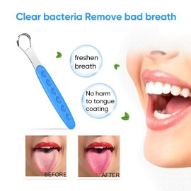 New Version Tongue Scraper Cleaner for Adults & Kids, Medical Grade Metal Tongue Brushes Set for Fresh Breath Dental Eliminate Bad Breath in Seconds (4 pcs) New Version Tongue Scraper Cleaner for Adults & Kids, Medical Grade Metal Tongue Brushes Set for Fresh Breath Dental Eliminate Bad Breath in Seconds (4 pcs)