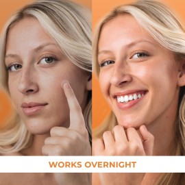 PatchRx Acne Patches (120 Count) with Hydrocolloid Only, Hydrocolloid Pimple Patches for Face - Zit Patch Acne Dots - Acne Patches - Pimple Patch with 3 Size Acne Stickers