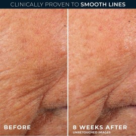 RoC Retinol Correxion Anti-Aging Wrinkle Night Serum, Daily Line Smoothing Skin Care Treatment for Fine Lines, Post-Acne Scars, 30 Individual Capsules, Unscented, 0.35 Fl Oz RoC Retinol Correxion Anti-Aging Wrinkle Night Serum, Daily Line Smoothing Skin Care Treatment for Fine Lines, Post-Acne Scars, 30 Individual Capsules, Unscented, 0.35 Fl Oz