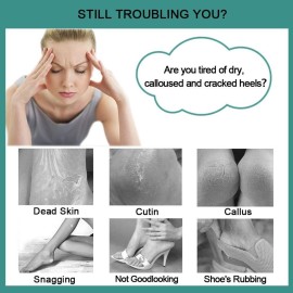 CAREHOOD Foot File Callus Remover - Multi Purpose 4 in 1 Feet Pedicure Tools with Foot Scrubber, Pumice Stone, Foot Rasp and Sand Paper for Home Foot Care (Red Pedicure Foot File) CAREHOOD Foot File Callus Remover - Multi Purpose 4 in 1 Feet Pedicure Tools with Foot Scrubber, Pumice Stone, Foot Rasp and Sand Paper for Home Foot Care (Red Pedicure Foot File)