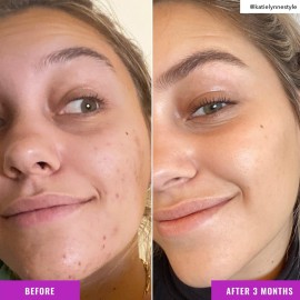 Good Molecules Niacinamide Brightening Toner - Facial Toner with Niacinamide, Vitamin C and Arbutin for Even Tone, Enlarged Pores - Skincare for Face Good Molecules Niacinamide Brightening Toner - Facial Toner with Niacinamide, Vitamin C and Arbutin for Even Tone, Enlarged Pores - Skincare for Face