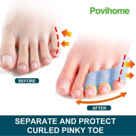 Povihome 10 Pack Pinky Toe Separator and Protectors for Overlapping Toe, Curled Pinky Toes - Spacers for Morton\'s Neuroma Pain Relief
