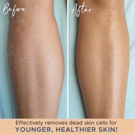 Exfoliating Glove - Shower Gloves for Body Scrub for Women & Men, Body Scrubber Mitt