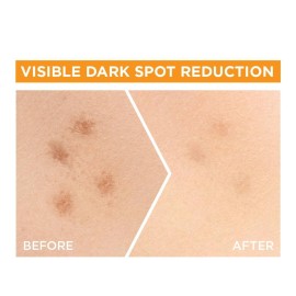 Garnier Bright Complete VITAMIN C Booster Face Serum, 30ml Garnier Bright Complete VITAMIN C Booster Face Serum, 30ml