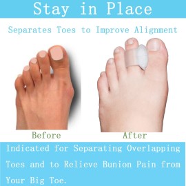 MENOCADY Pack of 12 Gel Toe Separator, (1/4 Thick) Big Toe Spacers, Single Loop Toe Spreader for Bunions, Overlapping Toe, Corrector and Spacer (Clear) MENOCADY Pack of 12 Gel Toe Separator, (1/4 Thick) Big Toe Spacers, Single Loop Toe Spreader for Bunions, Overlapping Toe, Corrector and Spacer (Clear)