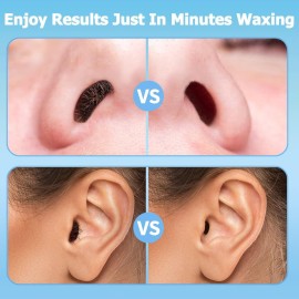 Nose Wax Hair Removal Kit by CoFashion | 100g Wax, 30 Applicators (15-30 Uses) | Painless, Quick & Easy for Men | 15 Mustache Guards, 2 Silicone Cups Nose Wax Hair Removal Kit by CoFashion | 100g Wax, 30 Applicators (15-30 Uses) | Painless, Quick & Easy for Men | 15 Mustache Guards, 2 Silicone Cups