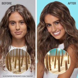 Neutrogena Moisturizing Healthy Scalp Hydro Boost Conditioner for Dry Hair and Scalp, with Hydrating Hyaluronic Acid, pH-Balanced, Paraben & Phthalate-Free, Color-Safe, 12 fl oz Neutrogena Moisturizing Healthy Scalp Hydro Boost Conditioner for Dry Hair and Scalp, with Hydrating Hyaluronic Acid, pH-Balanced, Paraben & Phthalate-Free, Color-Safe, 12 fl oz