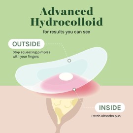 AOA Studio Absorbing Cover Healing Invisible Acne Patch Blemish Spot, Treatment, Facial Acne Patch Vegan, Cruelty Free, Hydrocolloid, Two Sizes 10mm 12mm (Total 84 Counts) AOA Studio Absorbing Cover Healing Invisible Acne Patch Blemish Spot, Treatment, Facial Acne Patch Vegan, Cruelty Free, Hydrocolloid, Two Sizes 10mm 12mm (Total 84 Counts)