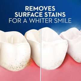 Oral-B Pulsar Battery Toothbrush with Charcoal Infused Bristles, Soft, 2 Count Oral-B Pulsar Battery Toothbrush with Charcoal Infused Bristles, Soft, 2 Count