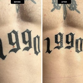 Mad Rabbit Tattoo Aftercare Soothing Gel & Moisturizer As Seen on Shark Tank - Premium Tattoo Supplies for New Tattoo Care, Anti-Itch - Tattoo Care Gel Made with Clean Ingredients Mad Rabbit Tattoo Aftercare Soothing Gel & Moisturizer As Seen on Shark Tank - Premium Tattoo Supplies for New Tattoo Care, Anti-Itch - Tattoo Care Gel Made with Clean Ingredients