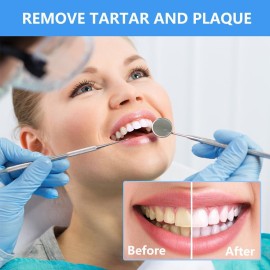 SENLMLER Dental Tools, Professional Plaque Remover Teeth Cleaning Tool Kit, Stainless Steel Dental Pick Tartar Scraper Tooth Cleaner, Oral Care Hygiene Set for Dentist Personal Pets with Storage Box SENLMLER Dental Tools, Professional Plaque Remover Teeth Cleaning Tool Kit, Stainless Steel Dental Pick Tartar Scraper Tooth Cleaner, Oral Care Hygiene Set for Dentist Personal Pets with Storage Box