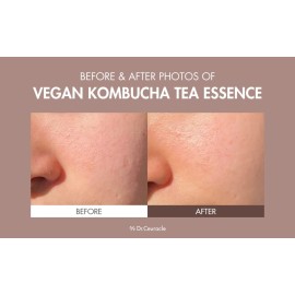 Dr.Ceuracle Vegan Kombucha Cream Essence Toner - Korean Skincare Hydrating Milky Toner with Kombucha Tea Extract, Centella Asiatica, Ceramide (150 ml / 5.07 fl. oz.) Dr.Ceuracle Vegan Kombucha Cream Essence Toner - Korean Skincare Hydrating Milky Toner with Kombucha Tea Extract, Centella Asiatica, Ceramide (150 ml / 5.07 fl. oz.)