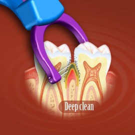 T.Smile Evolutionary Clean Dental Flossers, Kit of Refills Plus Long Handle (200 T-Tension Refills) T.Smile Evolutionary Clean Dental Flossers, Kit of Refills Plus Long Handle (200 T-Tension Refills)