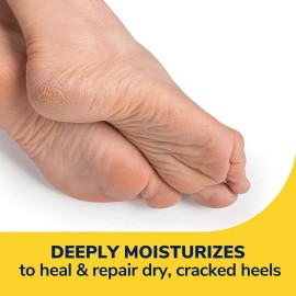 Dr. Scholl\'s Severe Cracked Heel Repair Restoring Balm 2.5oz, with 25% Urea for Dry, Cracked Feet, Heals and Moisturizes for Healthy Feet Dr. Scholl\'s Severe Cracked Heel Repair Restoring Balm 2.5oz, with 25% Urea for Dry, Cracked Feet, Heals and Moisturizes for Healthy Feet