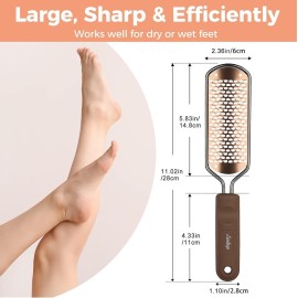 Foot File Foot Scrubber Pedicure - Callus Remover for Feet Easkep Professional Grater Rasp Foot Scraper Corns Callous Removers Cracked Dead Skin Remover for Dry and Wet Feet (Golden) Foot File Foot Scrubber Pedicure - Callus Remover for Feet Easkep Professional Grater Rasp Foot Scraper Corns Callous Removers Cracked Dead Skin Remover for Dry and Wet Feet (Golden)