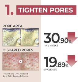 numbuzin No.3 Serum | Skin Softening Serum | Pores, Textured, Bumpy, Rough to Glass Skin | Bifida, Galactomyces, Niacinamide, Adenosine, Panthenol | 1.69 fl. oz. numbuzin No.3 Serum | Skin Softening Serum | Pores, Textured, Bumpy, Rough to Glass Skin | Bifida, Galactomyces, Niacinamide, Adenosine, Panthenol | 1.69 fl. oz.