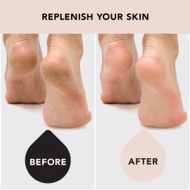 Kitsch Moisturizing Socks for Cracked Heel Treatment, Insulated Gel Socks & Moisturizing Heel Socks for Dry Cracked Feet Women Men, Spa & Sleep Socks for Overnight Moisture Repair, 1 Reusable Pair Kitsch Moisturizing Socks for Cracked Heel Treatment, Insulated Gel Socks & Moisturizing Heel Socks for Dry Cracked Feet Women Men, Spa & Sleep Socks for Overnight Moisture Repair, 1 Reusable Pair