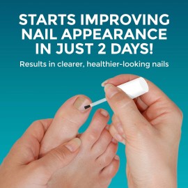 Opti-Nail Fungal Nail Repair with Brush Applicator, Restores the Healthy Appearance of Nails Discolored or Damaged by Nail Fungus Opti-Nail Fungal Nail Repair with Brush Applicator, Restores the Healthy Appearance of Nails Discolored or Damaged by Nail Fungus