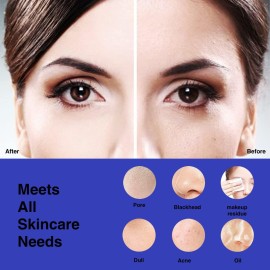 NgraCoola CLIE Facial Cleansing Brush, Waterproof and Rechargeable Face Scrub Brush for Men & Women, Cleansing, Exfoliating and Massaging, Electric Face Scrubber - Blue