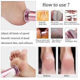 Electric Foot File Callus Remover Professional Foot Sander Grinder Scrubber Foot File Pedicure Tools Adjustable Speed 60 Replacement Sandpaper disc Easy to Remove Cutin Dead Skin calluses-Rose Gold
