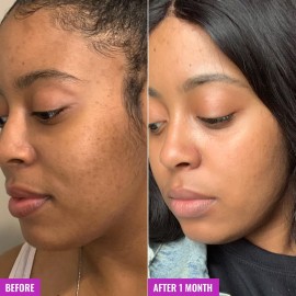 Good Molecules Glycolic Exfoliating Toner - Hyaluronic and Glycolic Acid Daily Toner for Face - Cleansing Facial Exfoliant for Glowing Even Skin Tone, Skin Care Good Molecules Glycolic Exfoliating Toner - Hyaluronic and Glycolic Acid Daily Toner for Face - Cleansing Facial Exfoliant for Glowing Even Skin Tone, Skin Care