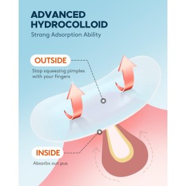 ZATKTK Acne Pimple Patch (180 Counts 4 Sizes), Invisible Hydrocolloid Acne Patch with Tea Tree Oil & Calendula Oil, Acne Spot Patch Zit Patches for Face ZATKTK Acne Pimple Patch (180 Counts 4 Sizes), Invisible Hydrocolloid Acne Patch with Tea Tree Oil & Calendula Oil, Acne Spot Patch Zit Patches for Face