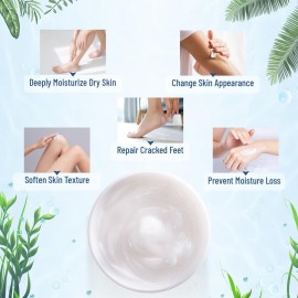 OUKEYA Urea Cream 40 Percent,Foot & Hand Cream for Dry Cracked,Urea Lotion for Feet Maximum Strength OUKEYA Urea Cream 40 Percent,Foot & Hand Cream for Dry Cracked,Urea Lotion for Feet Maximum Strength