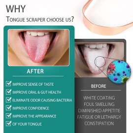 RONAVO Copper Tongue Scraper for Adults (2 Pack), 100% Pure Copper, Naturally Anti-Microbial, Banishes Bad Breath and Maintains Oral Hygiene, Tongue Cleaner with Travel Case, Easy to Use and Clean RONAVO Copper Tongue Scraper for Adults (2 Pack), 100% Pure Copper, Naturally Anti-Microbial, Banishes Bad Breath and Maintains Oral Hygiene, Tongue Cleaner with Travel Case, Easy to Use and Clean