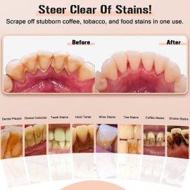 Plaque Remover for Teeth, Electric Tooth Cleaner Tartar Remover for Teeth with LED Light,4 Modes Rechargeable Teeth Cleaning Kit with Dental Tools, 2 Replaceable Heads (White A) Plaque Remover for Teeth, Electric Tooth Cleaner Tartar Remover for Teeth with LED Light,4 Modes Rechargeable Teeth Cleaning Kit with Dental Tools, 2 Replaceable Heads (White A)