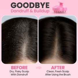 RELAXXO Scalp Massager Hair Growth - Exfoliator & Hair Scrubber for Scalp, Soft Bristles for Dandruff & Soothing Comfort, Shampoo Brush, Wet & Dry Use, Pink RELAXXO Scalp Massager Hair Growth - Exfoliator & Hair Scrubber for Scalp, Soft Bristles for Dandruff & Soothing Comfort, Shampoo Brush, Wet & Dry Use, Pink