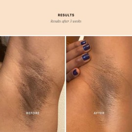 Bushbalm Dark Spot Exfoliating Scrub - Natural Body Scrub Exfoliant to Hydrated, Soften and Enhance Glow in Skin - Bermuda 236 ml Bushbalm Dark Spot Exfoliating Scrub - Natural Body Scrub Exfoliant to Hydrated, Soften and Enhance Glow in Skin - Bermuda 236 ml