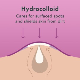 Rael Pimple Patches - Miracle Overnight Spot Cover, Thicker & Extra Adhesion, Hydrocolloid Acne Treatment for Face, Zits & Blemishes, Korean Skin Care, Vegan & Cruelty-Free, 3 Sizes (104 Count) Rael Pimple Patches - Miracle Overnight Spot Cover, Thicker & Extra Adhesion, Hydrocolloid Acne Treatment for Face, Zits & Blemishes, Korean Skin Care, Vegan & Cruelty-Free, 3 Sizes (104 Count)