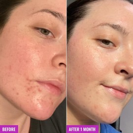 Good Molecules Clarify and Cleanse Bar - Soap-Free Bar with Salicylic Acid BHA, Tea Tree, Kaolin Clay to Hydrate - Skincare for Face and Body Good Molecules Clarify and Cleanse Bar - Soap-Free Bar with Salicylic Acid BHA, Tea Tree, Kaolin Clay to Hydrate - Skincare for Face and Body