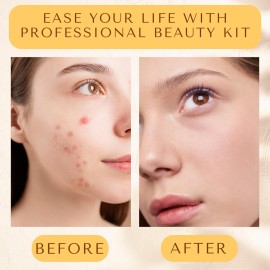 [16 Pcs] Blackhead Remover Tools 2025 Latest Pimple Popper Tool Kit | Stainless Steel Professional Pimple Extractor Tool Kit for Blackheads, Blemish, Comdone, Acne, Zit, and Whiteheads for Face & Nose