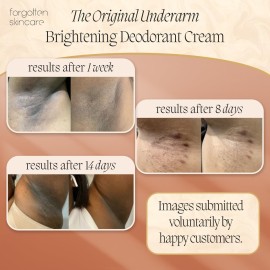 Forgotten Skincare The Original Underarm Brightening Deodorant Cream For Dark Underarms Treatment, Body Odor Eliminator For Women & Men, Ingrown Hair Treatment, Vitamin C & Salicylic Acid Forgotten Skincare The Original Underarm Brightening Deodorant Cream For Dark Underarms Treatment, Body Odor Eliminator For Women & Men, Ingrown Hair Treatment, Vitamin C & Salicylic Acid