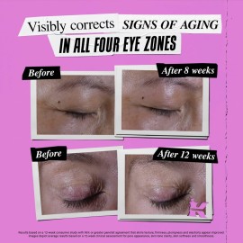 Kiehl\'s Super Multi-Corrective Eye Cream, Anti-Aging Cream that Lifts Brow Bone Area, Smooths and Firms Eye Lids, Bilberry Seed Extract and Collagen Peptide for Smoother Looking Skin - 0.5 fl oz Kiehl\'s Super Multi-Corrective Eye Cream, Anti-Aging Cream that Lifts Brow Bone Area, Smooths and Firms Eye Lids, Bilberry Seed Extract and Collagen Peptide for Smoother Looking Skin - 0.5 fl oz