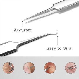 Professional Facial Blackhead Remover Tweezers,3Pcs Precision Pimple Popper Tool Kit for Whitehead Ance Blemishs Comedones Stainless Steel Makeup Tool - Matte Professional Facial Blackhead Remover Tweezers,3Pcs Precision Pimple Popper Tool Kit for Whitehead Ance Blemishs Comedones Stainless Steel Makeup Tool - Matte