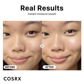 COSRX Pure Sodium Hyaluronic Acid 3% Serum, Hydration & Moisture Boosting Facial Serum for Fine Lines & Wrinkles, Plump & Repair Dry Skin, 0.67fl.oz/20ml, No Artificial Fragrance, Korean Skin Care COSRX Pure Sodium Hyaluronic Acid 3% Serum, Hydration & Moisture Boosting Facial Serum for Fine Lines & Wrinkles, Plump & Repair Dry Skin, 0.67fl.oz/20ml, No Artificial Fragrance, Korean Skin Care