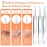 Pimple Popper Tool Kit, IUMAKEVP 15 PCS Professional Stainless Steel Blackhead Remover Comedone Extractor Tools for Removing Zit on Face - Acne Removal Kit with Metal Case (Silver)