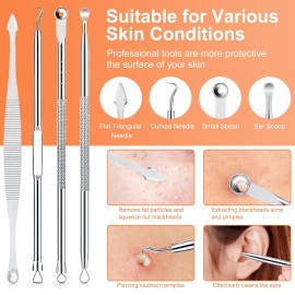 Pimple Popper Tool Kit, IUMAKEVP 15 PCS Professional Stainless Steel Blackhead Remover Comedone Extractor Tools for Removing Zit on Face - Acne Removal Kit with Metal Case (Silver) Pimple Popper Tool Kit, IUMAKEVP 15 PCS Professional Stainless Steel Blackhead Remover Comedone Extractor Tools for Removing Zit on Face - Acne Removal Kit with Metal Case (Silver)