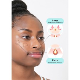 OLIVE YOUNG Care Plus Spot Patch | Hydrocolloid Acne Korean Spot Patch to Cover Zits, Pimples and Blemishes, for Troubled Skin and Face (Hydrocolloid, 306 Count (Pack of 3))