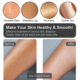 Yiclick Heavy Exfoliating Gloves, Exfoliating Body Scrubber for Bath Shower Exfoliation, Body Scrub Exfoliator for Dead Skin Remover, Exfoliate Sponge Loofah Washcloth Mitt Men Women Yiclick Heavy Exfoliating Gloves, Exfoliating Body Scrubber for Bath Shower Exfoliation, Body Scrub Exfoliator for Dead Skin Remover, Exfoliate Sponge Loofah Washcloth Mitt Men Women