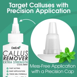 DeEnti Callus Remover for Feet, Extra Strength Foot Callus Remover Gel, 8oz Salon Grade Home Pedicure Supplies for Dry Skin, Cracked Heel, Professional Strength Foot Care, Cool Mint DeEnti Callus Remover for Feet, Extra Strength Foot Callus Remover Gel, 8oz Salon Grade Home Pedicure Supplies for Dry Skin, Cracked Heel, Professional Strength Foot Care, Cool Mint