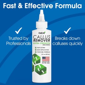 DeEnti Callus Remover for Feet, Extra Strength Foot Callus Remover Gel, 8oz Salon Grade Home Pedicure Supplies for Dry Skin, Cracked Heel, Professional Strength Foot Care, Unscented DeEnti Callus Remover for Feet, Extra Strength Foot Callus Remover Gel, 8oz Salon Grade Home Pedicure Supplies for Dry Skin, Cracked Heel, Professional Strength Foot Care, Unscented